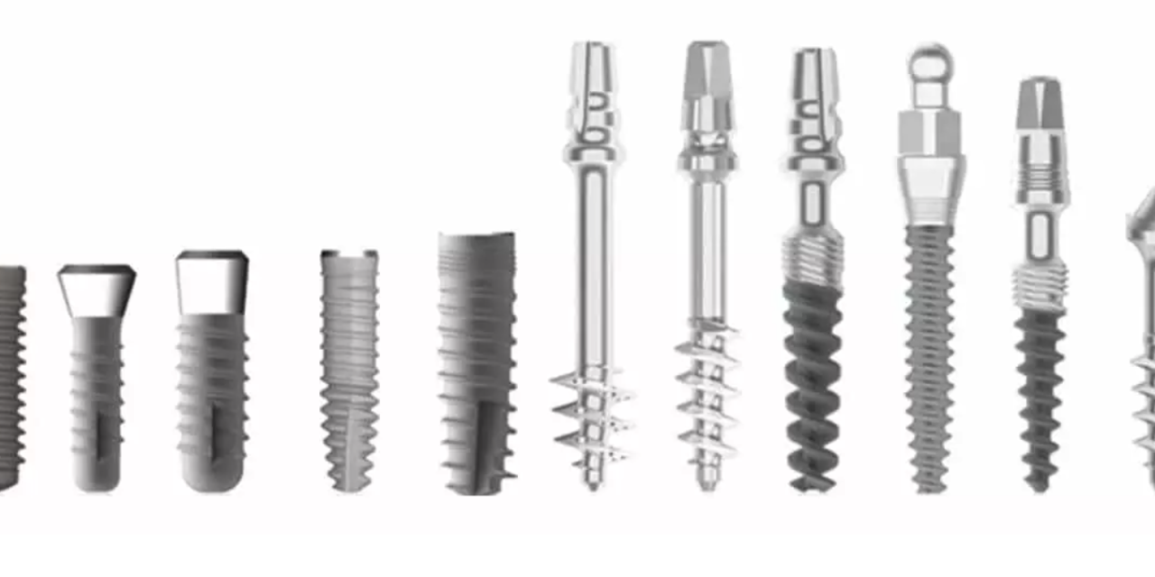 Los Diferentes Tipos de Implantes Dentales: Guía Completa